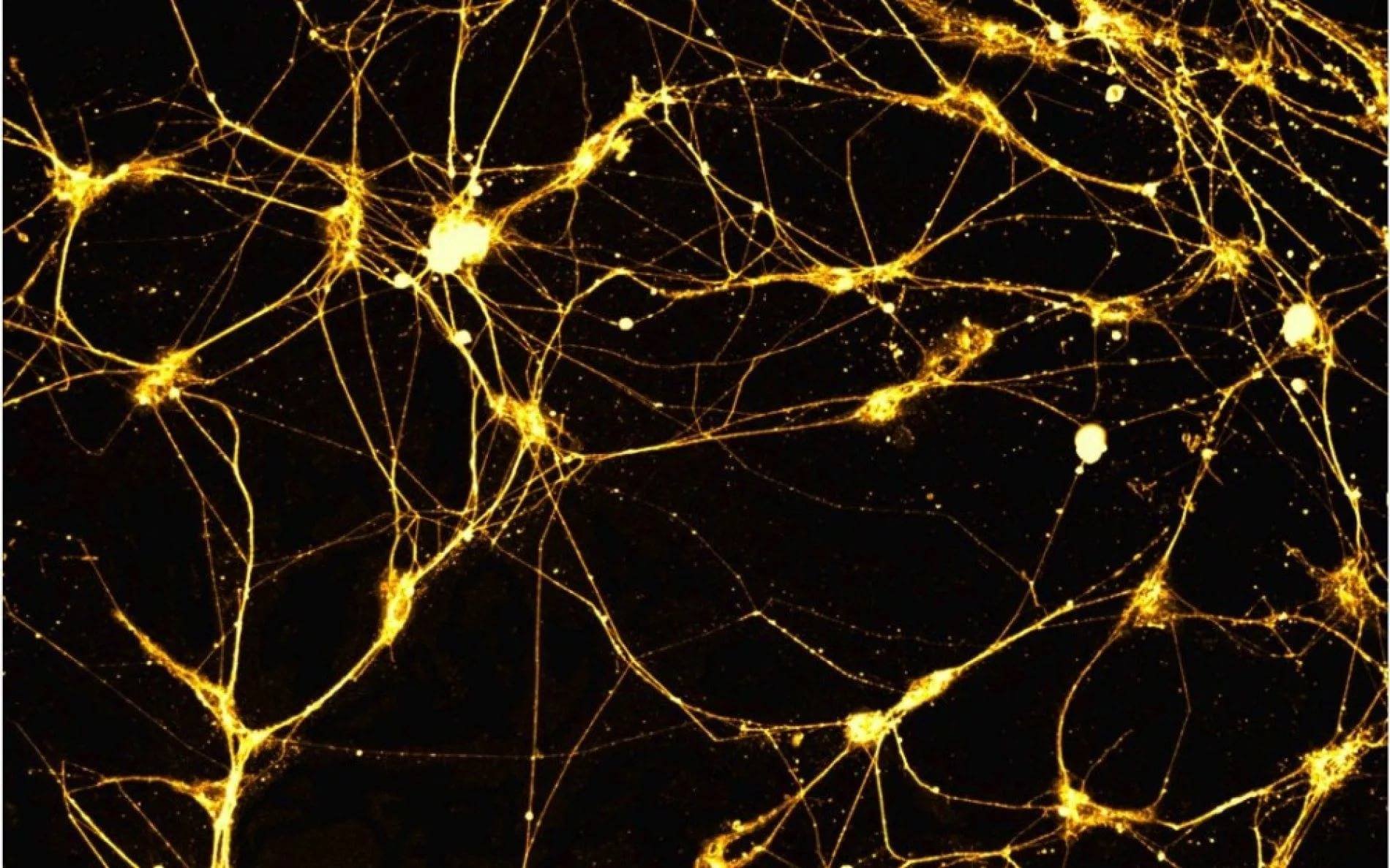 Айбро нейросеть. Нейросеть Нейроны. Искусственная нейронная сеть и Нейрон. Искусственная нейронная сеть. Нейронная сетка.